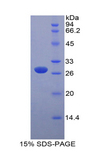 MYLK Protein - Recombinant Myosin Light Chain Kinase By SDS-PAGE