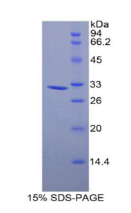 MYLK3 Protein - Recombinant Myosin Light Chain Kinase 3 By SDS-PAGE