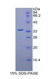 MYLK4 Protein - Recombinant Myosin Light Chain Kinase 4 By SDS-PAGE