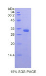 MYO1A Protein - Recombinant Myosin IA By SDS-PAGE