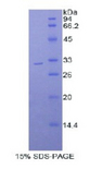MYO1B / Myosin IB Protein - Recombinant Myosin IB By SDS-PAGE