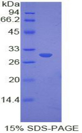 MYO1E / Myosin IE Protein - Recombinant Myosin IE By SDS-PAGE