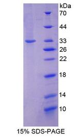NAT1 / AAC1 Protein - Recombinant N-Acetyltransferase 1 By SDS-PAGE