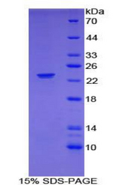 NCF2 / NOXA2 / p67phox Protein - Recombinant Neutrophil Cytosolic Factor 2 By SDS-PAGE