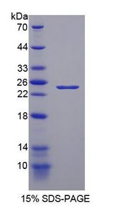 NEI3 / NEIL3 Protein - Recombinant Nei Endonuclease VIII Like Protein 3 By SDS-PAGE