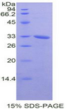 NEK2 Protein - Recombinant Never In Mitosis Gene A Related Kinase 2 By SDS-PAGE