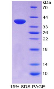 Neuropeptide S / NPS Protein - Recombinant  Neuropeptide S By SDS-PAGE