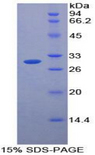Neurotrypsin Protein - Recombinant Protease, Serine 12 By SDS-PAGE