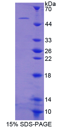NEXN / Nexilin Protein - Recombinant  Nexilin By SDS-PAGE