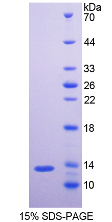 NF-L / NEFL Protein - Recombinant Neurofilament, Light Polypeptide By SDS-PAGE
