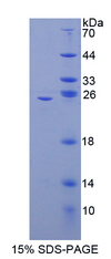 NFKB2 Protein - Recombinant Nuclear Factor Kappa B2 By SDS-PAGE