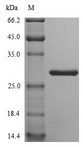 NID1 / Entactin / Nidogen-1 Protein - (Tris-Glycine gel) Discontinuous SDS-PAGE (reduced) with 5% enrichment gel and 15% separation gel.