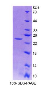 NIN / Ninein Protein - Recombinant Ninein By SDS-PAGE