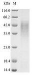 NIP3 / BNIP3 Protein - (Tris-Glycine gel) Discontinuous SDS-PAGE (reduced) with 5% enrichment gel and 15% separation gel.