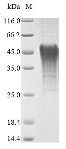 NIP3 / BNIP3 Protein - (Tris-Glycine gel) Discontinuous SDS-PAGE (reduced) with 5% enrichment gel and 15% separation gel.