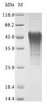 NIP3 / BNIP3 Protein - (Tris-Glycine gel) Discontinuous SDS-PAGE (reduced) with 5% enrichment gel and 15% separation gel.