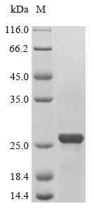 NIP3 / BNIP3 Protein - (Tris-Glycine gel) Discontinuous SDS-PAGE (reduced) with 5% enrichment gel and 15% separation gel.