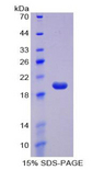NK1 / CD160 Protein - Recombinant Cluster Of Differentiation 160 By SDS-PAGE