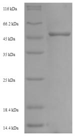 NKX2-2 Protein - (Tris-Glycine gel) Discontinuous SDS-PAGE (reduced) with 5% enrichment gel and 15% separation gel.