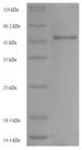 NKX2-2 Protein - (Tris-Glycine gel) Discontinuous SDS-PAGE (reduced) with 5% enrichment gel and 15% separation gel.
