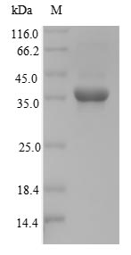 NKX3-2 / BAPX1 Protein - (Tris-Glycine gel) Discontinuous SDS-PAGE (reduced) with 5% enrichment gel and 15% separation gel.