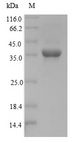 NKX3-2 / BAPX1 Protein - (Tris-Glycine gel) Discontinuous SDS-PAGE (reduced) with 5% enrichment gel and 15% separation gel.