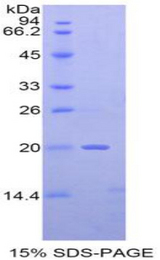 NME2 Protein - Recombinant Non Metastatic Cells 2, Protein NM23B Expressed In By SDS-PAGE