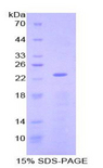 NME3 Protein - Recombinant Non Metastatic Cells 3, Protein NM23A Expressed In By SDS-PAGE
