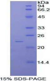 NME6 Protein - Recombinant Non Metastatic Cells 6, Protein Expressed In By SDS-PAGE