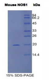 NOS1 / nNOS Protein - Recombinant Nitric Oxide Synthase 1, Neuronal By SDS-PAGE