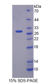 NOS1AP / CAPON Protein - Recombinant Nitric Oxide Synthase 1 Adaptor Protein By SDS-PAGE