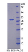 NOS1AP / CAPON Protein - Recombinant Nitric Oxide Synthase 1 Adaptor Protein By SDS-PAGE