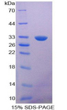 NOSTRIN Protein - Recombinant Nitric Oxide Synthase Trafficker By SDS-PAGE