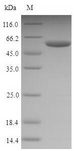 NPM1 / NPM / Nucleophosmin Protein - (Tris-Glycine gel) Discontinuous SDS-PAGE (reduced) with 5% enrichment gel and 15% separation gel.