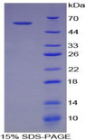 NPTX1 Protein - Recombinant Neuronal Pentraxin I By SDS-PAGE