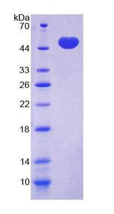 NR1H2 / LXR Beta Protein - Recombinant Liver X Receptor Beta (LXRb) by SDS-PAGE