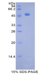 NR1I2 / PXR Protein - Recombinant Pregnane X Receptor By SDS-PAGE