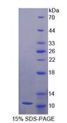 NRG4 Protein - Recombinant  Neuregulin 4 By SDS-PAGE