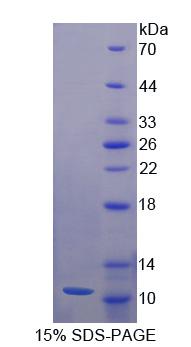 NRG4 Protein - Recombinant  Neuregulin 4 By SDS-PAGE