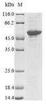 NRL Protein - (Tris-Glycine gel) Discontinuous SDS-PAGE (reduced) with 5% enrichment gel and 15% separation gel.