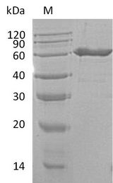 NT5E / eNT / CD73 Protein - (Tris-Glycine gel) Discontinuous SDS-PAGE (reduced) with 5% enrichment gel and 15% separation gel.