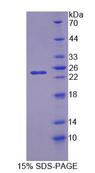 NT5M Protein - Recombinant 5'-Nucleotidase, Mitochondrial (NT5M) by SDS-PAGE