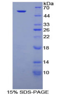 NTN1 / Netrin 1 Protein - Recombinant Netrin 1 By SDS-PAGE