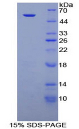NTN1 / Netrin 1 Protein - Recombinant Netrin 1 By SDS-PAGE