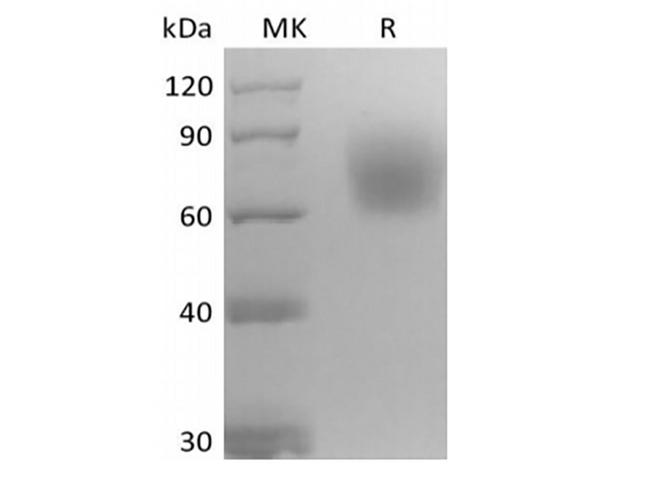 NTRK2 / TRKB Protein - Recombinant Mouse Neurotrophic Tyrosine Kinase Receptor Type 2/TrkB/NTRK2 (C-6His)