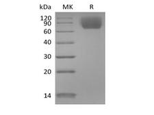 NTRK3 / TRKC Protein - Recombinant Mouse TrkC/Ntrk3 (C-6His)