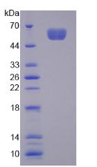 NUAK1 / ARK5 Protein - Recombinant NUAK Family SNF1 Like Kinase 1 By SDS-PAGE