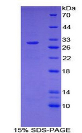 NUP107 Protein - Recombinant Nucleoporin 107kDa By SDS-PAGE