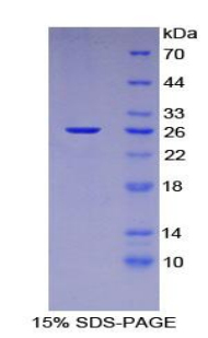 NUP133 Protein - Recombinant Nucleoporin 133kDa By SDS-PAGE