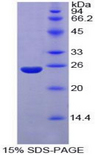 NUP160 Protein - Recombinant Nucleoporin 160kDa By SDS-PAGE